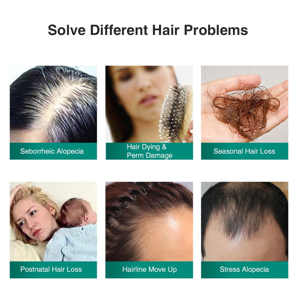 US Stock Ginger Hair Growth Spray Essential Oil Hair Loss Liquid Hair Growth Spray For Men Women Hair Care Tools