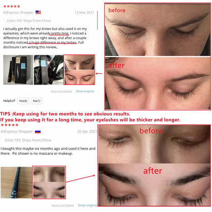 OMY LADY Eyelashes Growth Serum Eyelash Lift Extension Enhancer Longer Fuller Thicker Lengthening Natural Plants 5ml*2